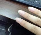 蚂蚁庄园今天小鸡考你问答 一般来说健康的手指甲是什么样子的