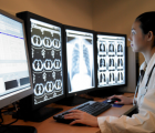 大学医院实施基于AI的移动X射线系统
